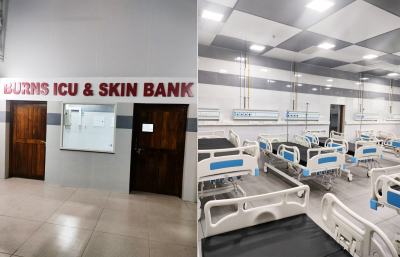 Advanced burns ICU has become a reality at Thiruvananthapuram Medical College